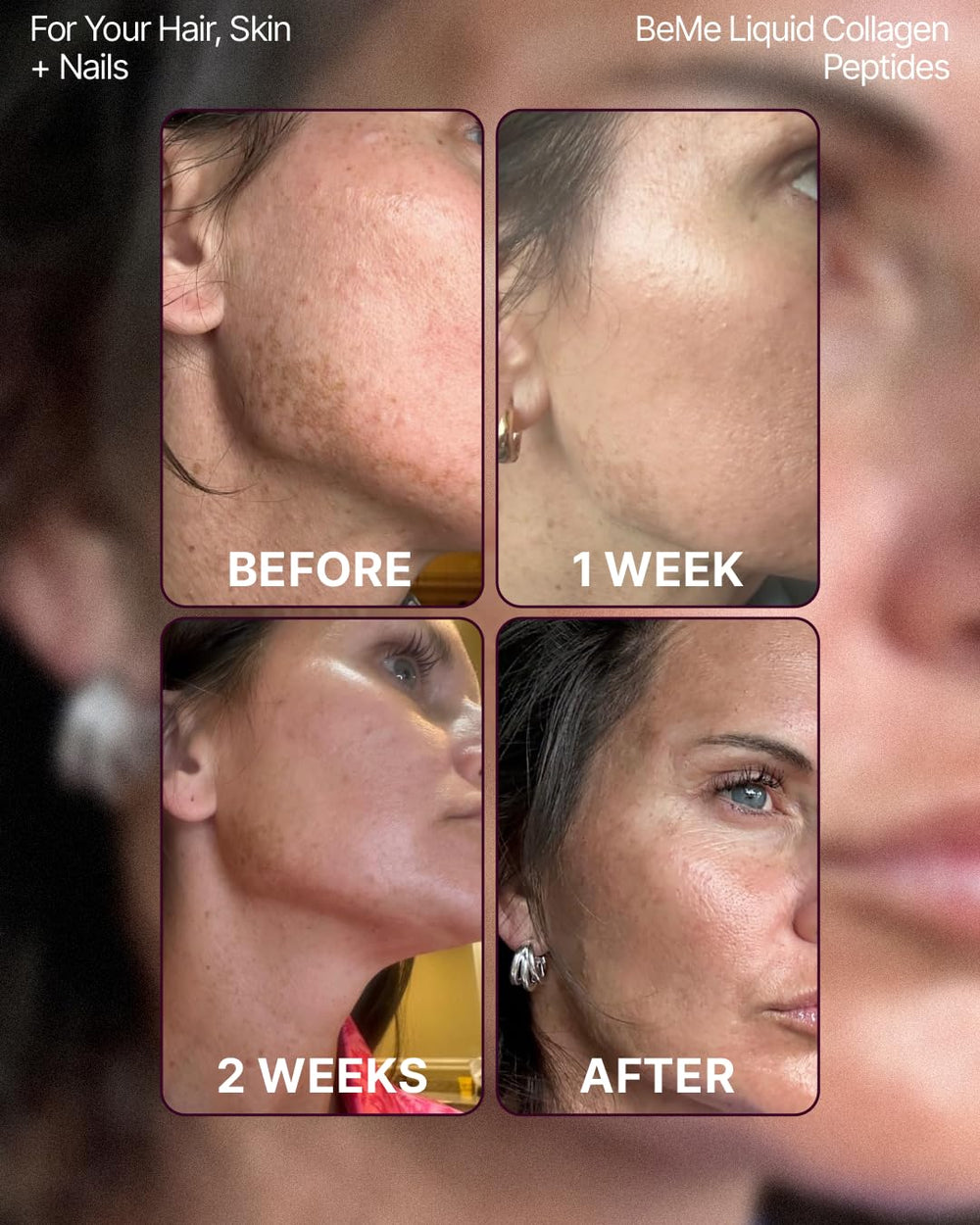 BeMe Liquid Collagen ingredients panel highlights VERISOL, Biotin, CoQ10, vitamins