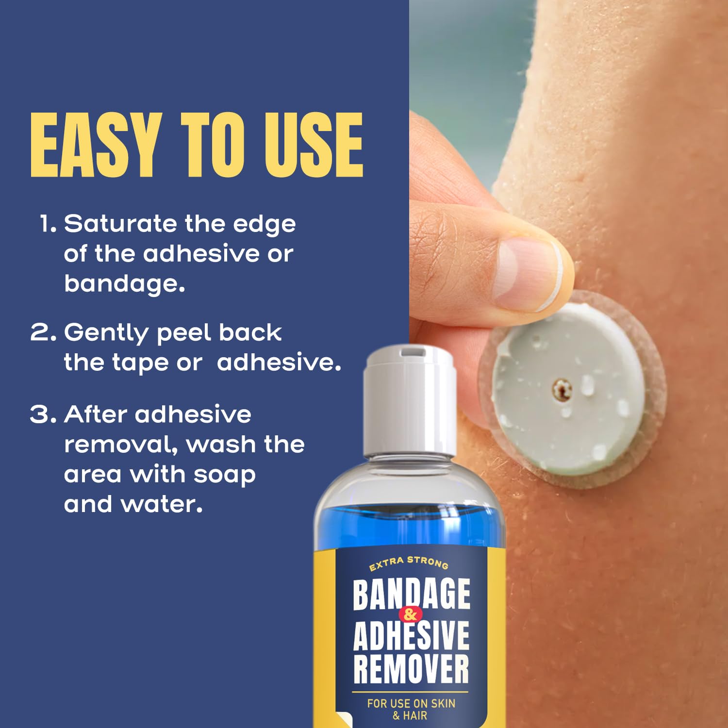 Berkland Sting-Free remover applied near a dialysis port for comfortable adhesive removal.