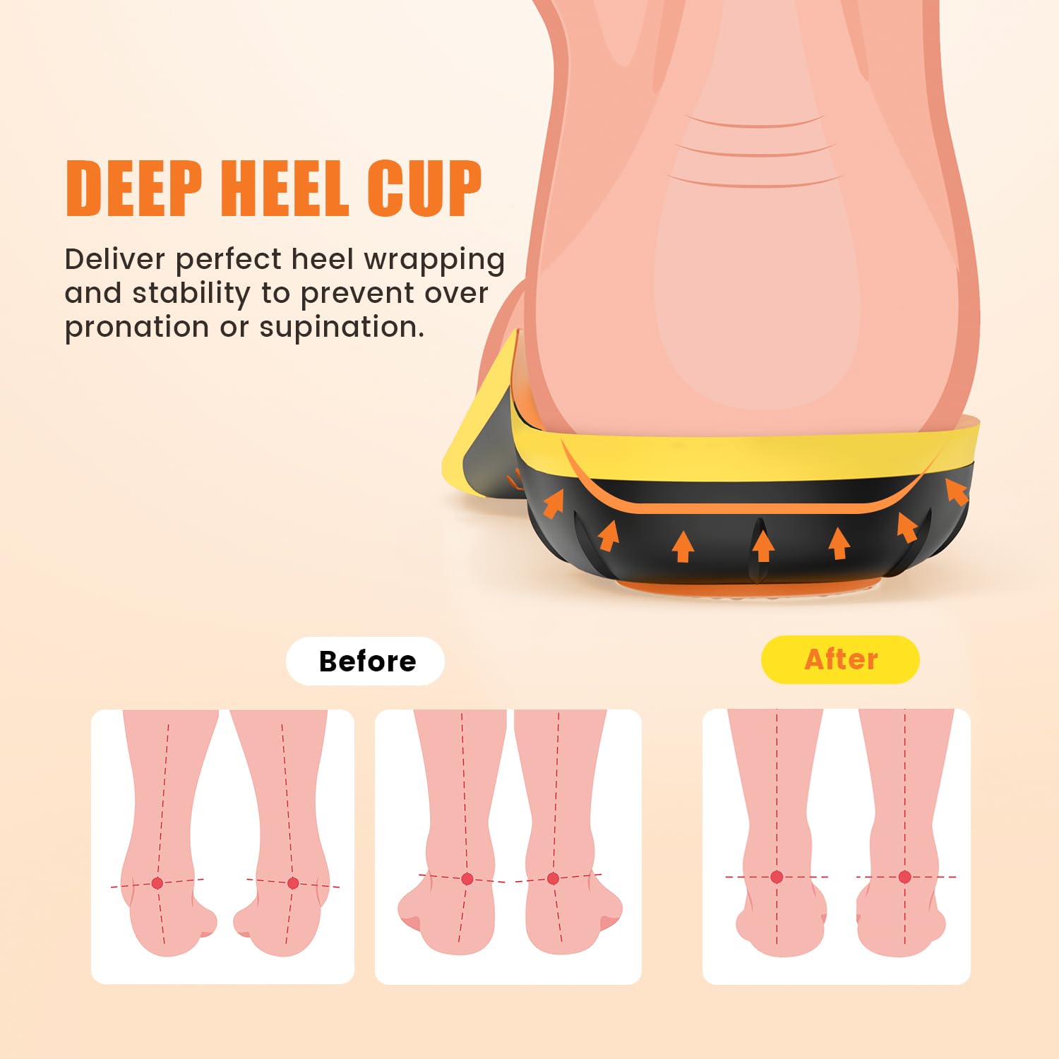 BestHalo high arch support improves foot posture for daily activities.