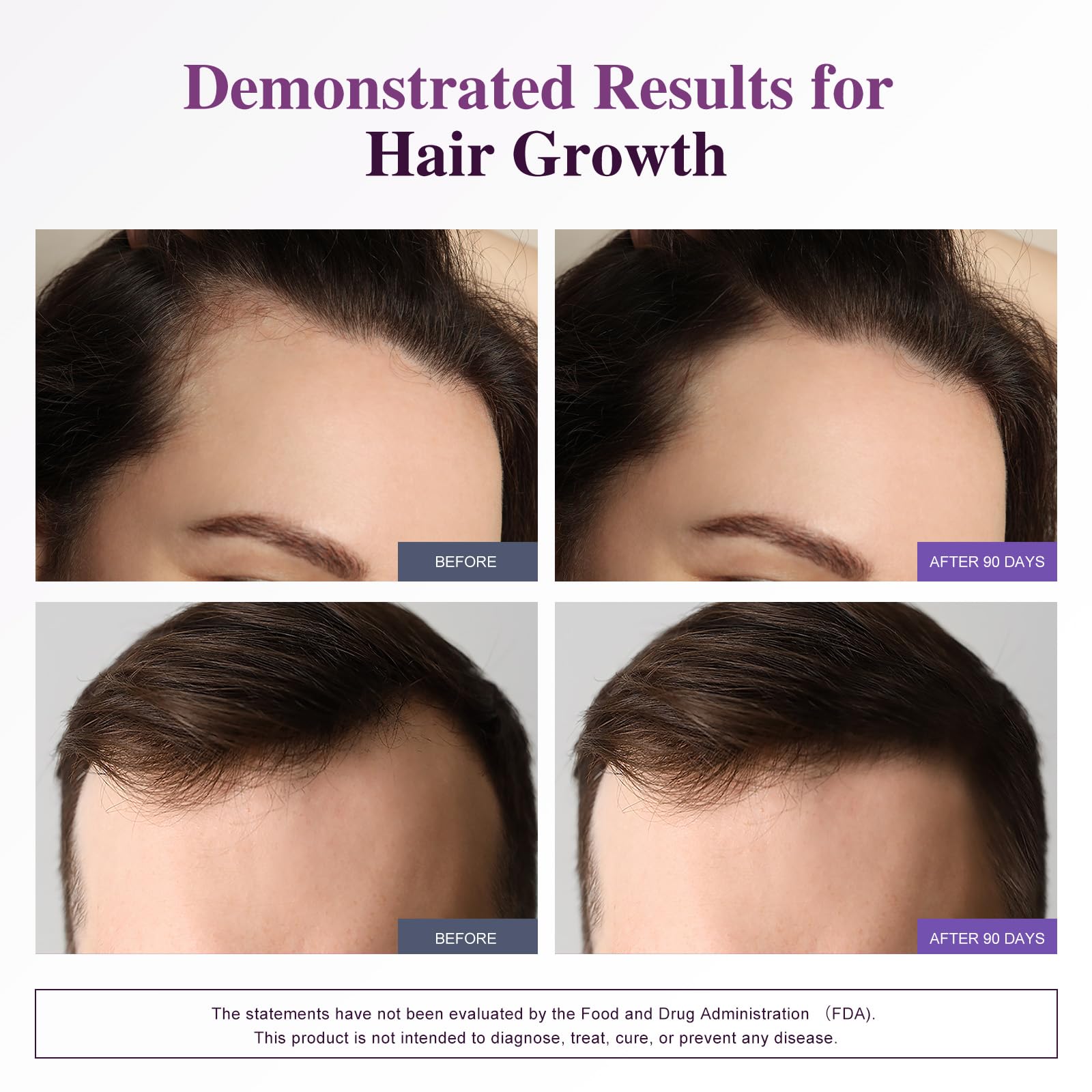 Bevalence Biotin ingredients panel reveals comprehensive multivitamin minerals.