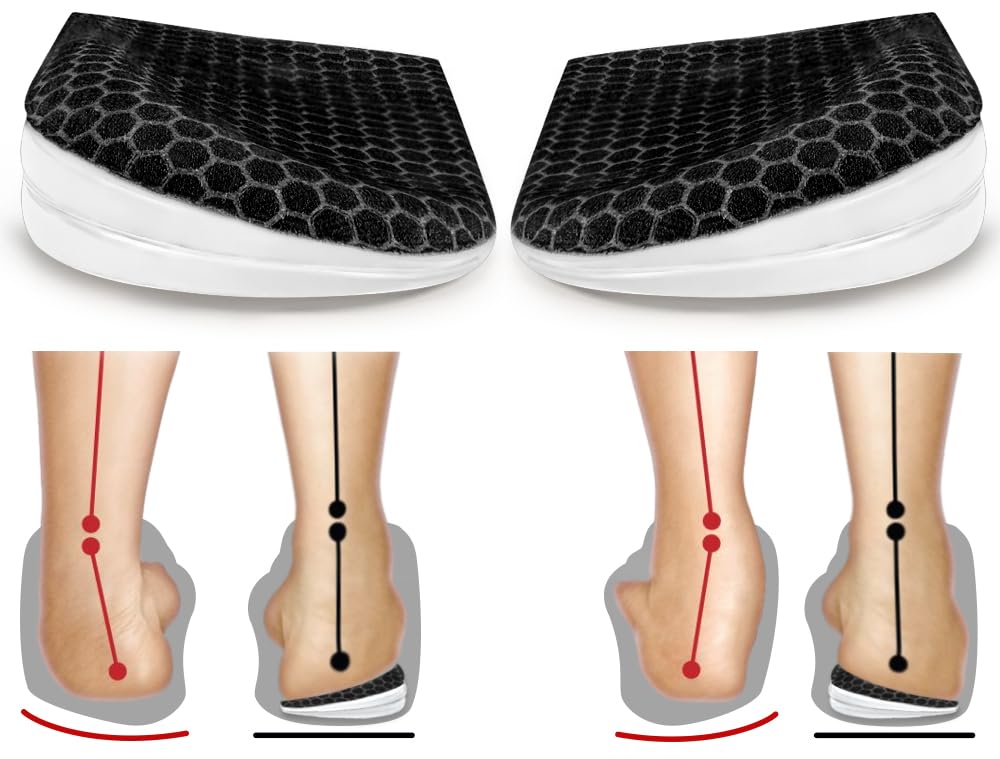 BIGGCOOL Corrective Insoles close-up highlighting medical-grade PU gel for all-day comfort.