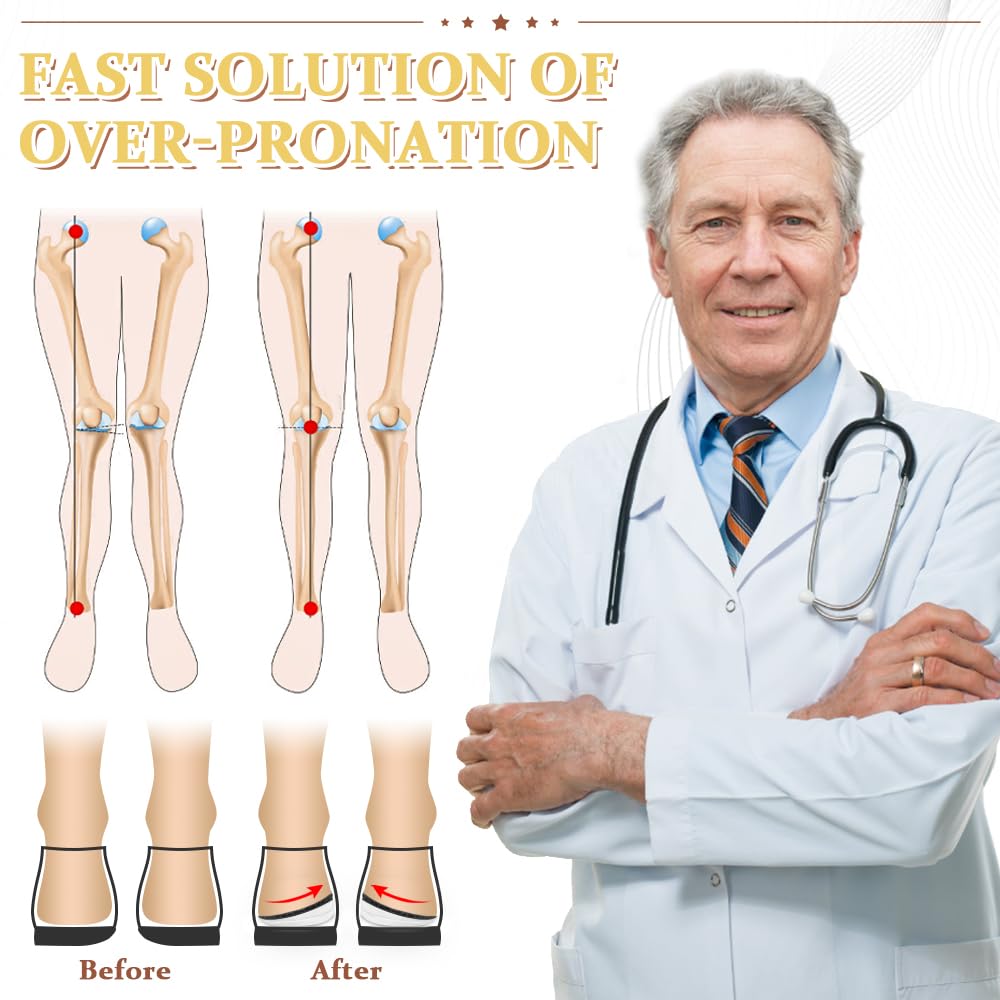 BIGGCOOL Corrective Insoles layered design demonstrating adjustable fit for personalized support.
