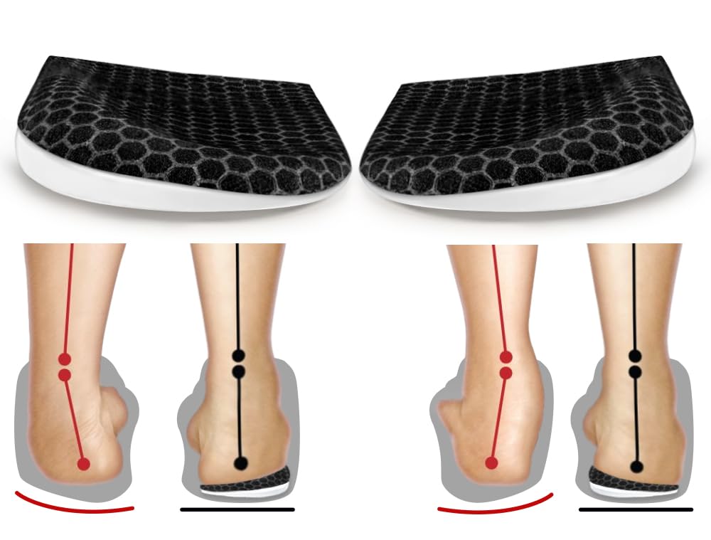 BIGGCOOL corrective insoles for supination improve alignment during daily activities.
