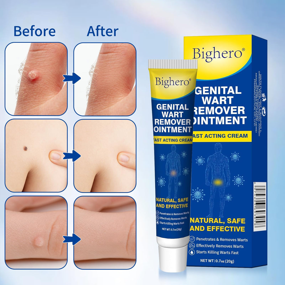 Bighero 2-pack wart remover kit offering value and ongoing treatment options.