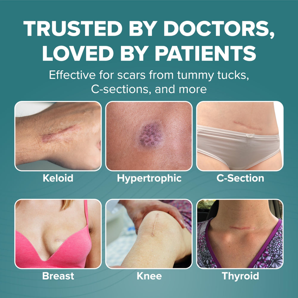 Biodermis Epiderm ideal for C-section and tummy tuck scar coverage.