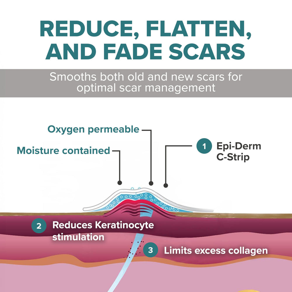 Biodermis Epiderm liner enables easy, precise application for better fit.