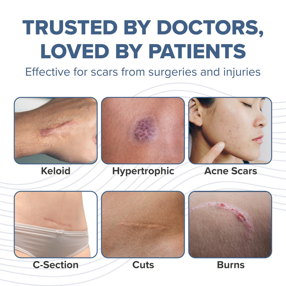 Trusted by clinicians for gentle scar management after surgeries or injuries