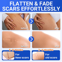 Bioemmalab perforated sheet design lets easy cut-to-fit for various scars.