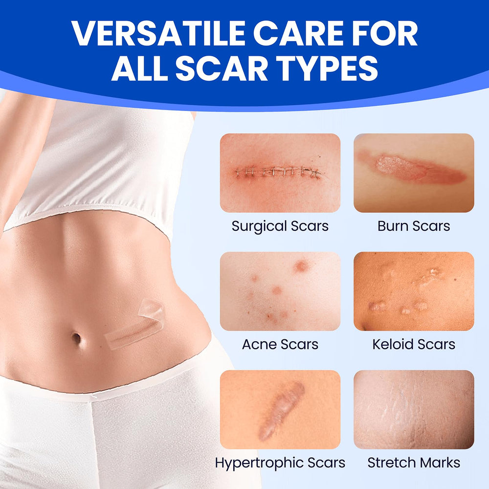 Bioemmalab perforated design makes it easy to fit scar areas.