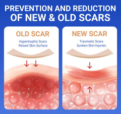 Bioemmalab strong adhesion keeps patch in place during activities.