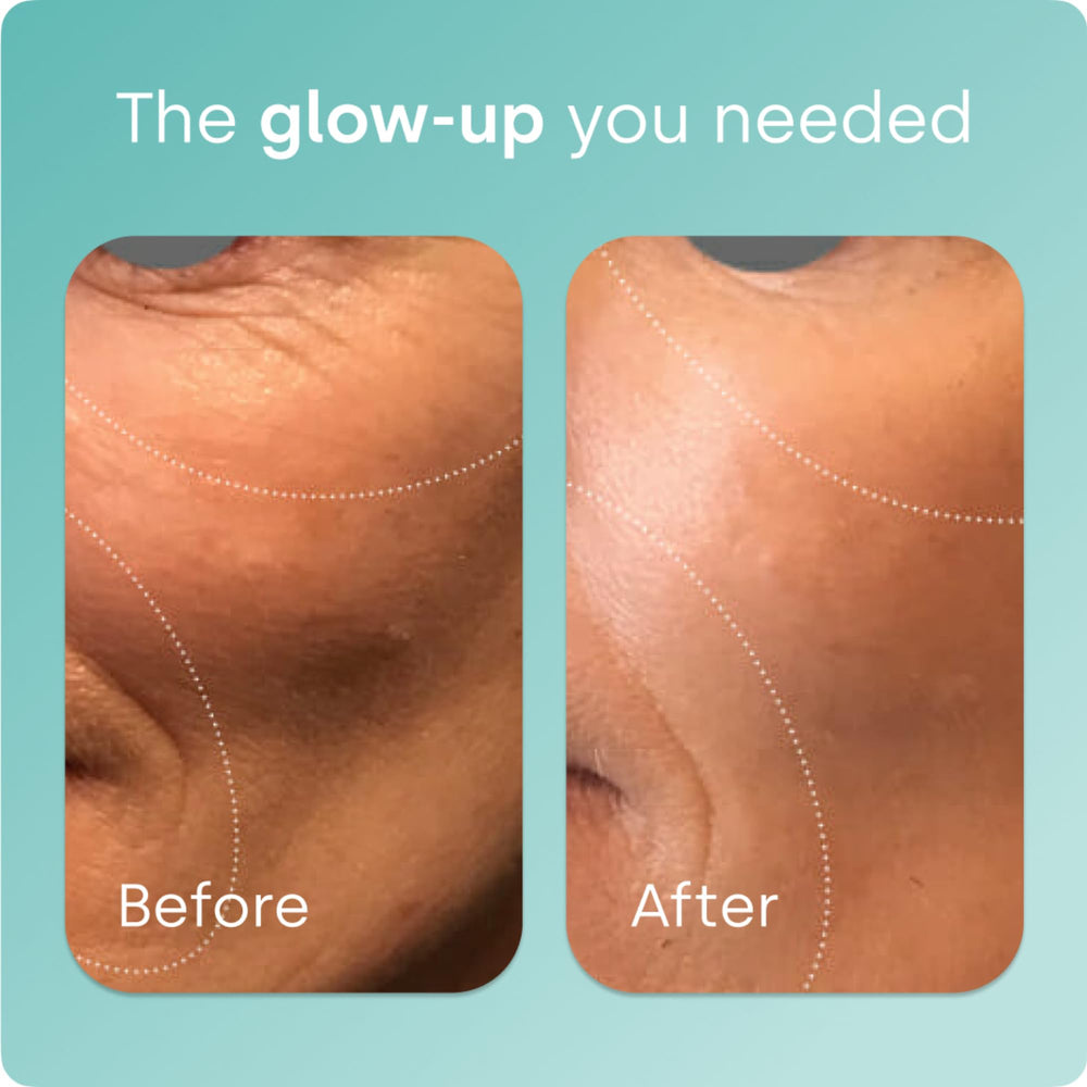 Biosil ch-OSA activator ingredient close-up underscores patented science behind activation.