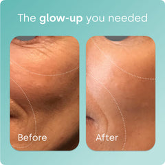 Biosil ch-OSA activator ingredient close-up underscores patented science behind activation.