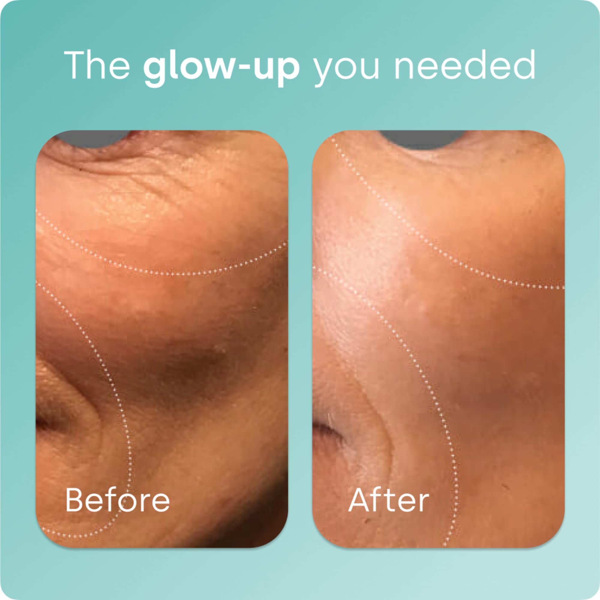 Biosil Collagen Booster daily dose displayed with glass of water.