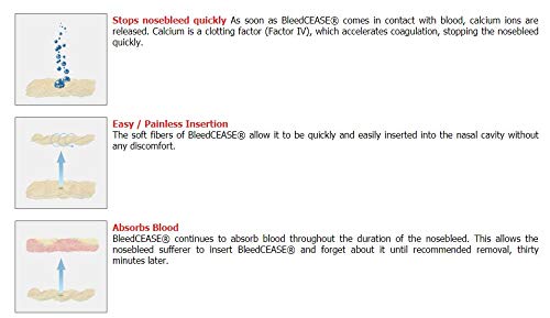 BleedCEASE blood-absorbent-mass illustrates ongoing absorption during a nosebleed