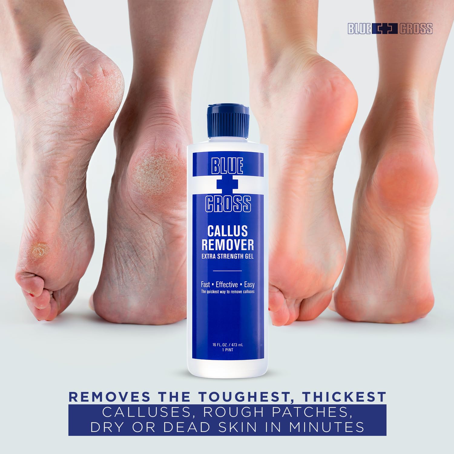 Blue Cross foot-care-kit display with gel for salon-like results.