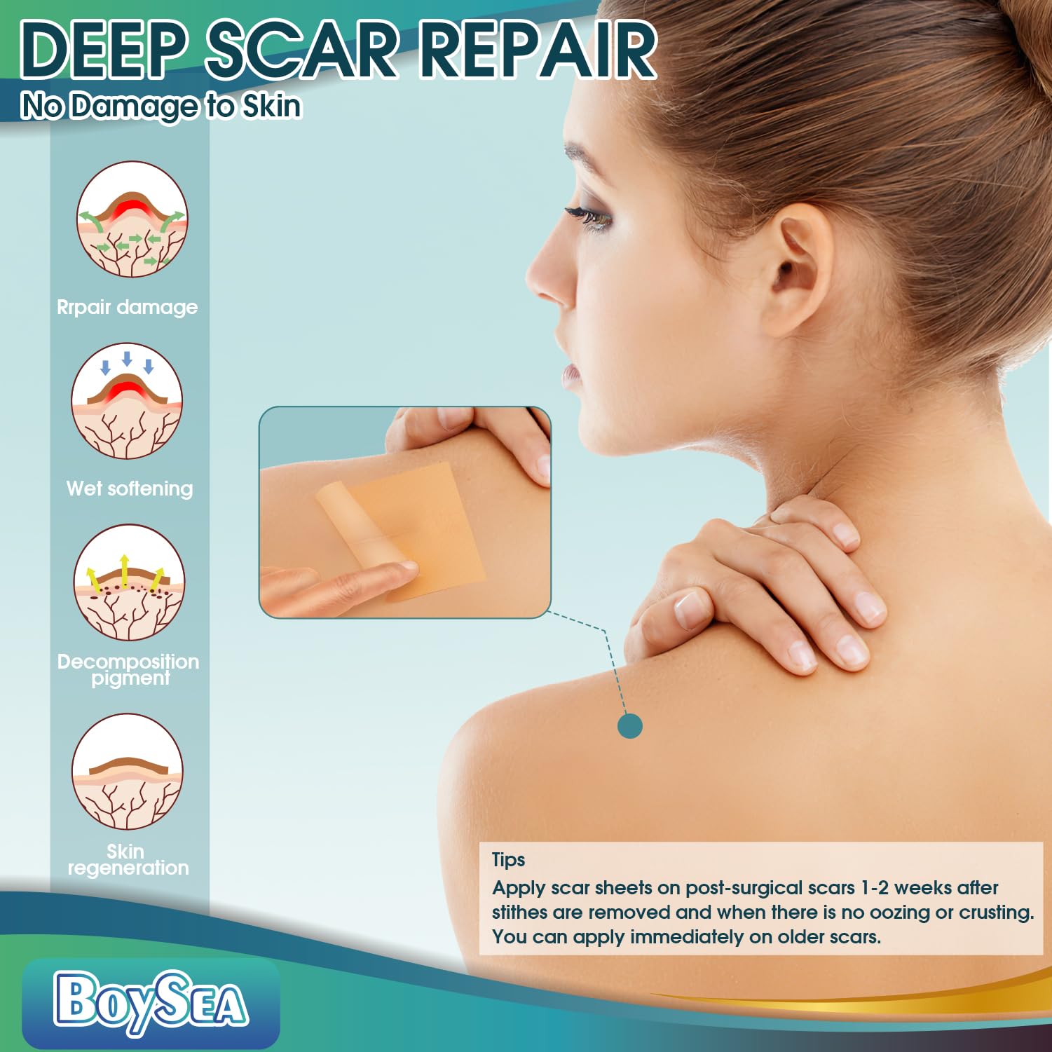 Boysea scar patch soft breathable material supports comfortable wear.