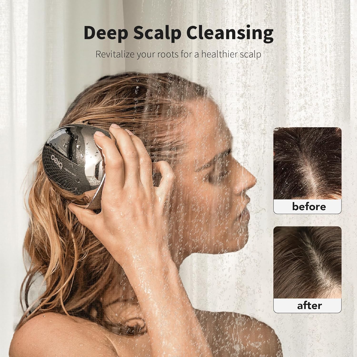 Breo removable massage nodes allow easy cleaning and customization.