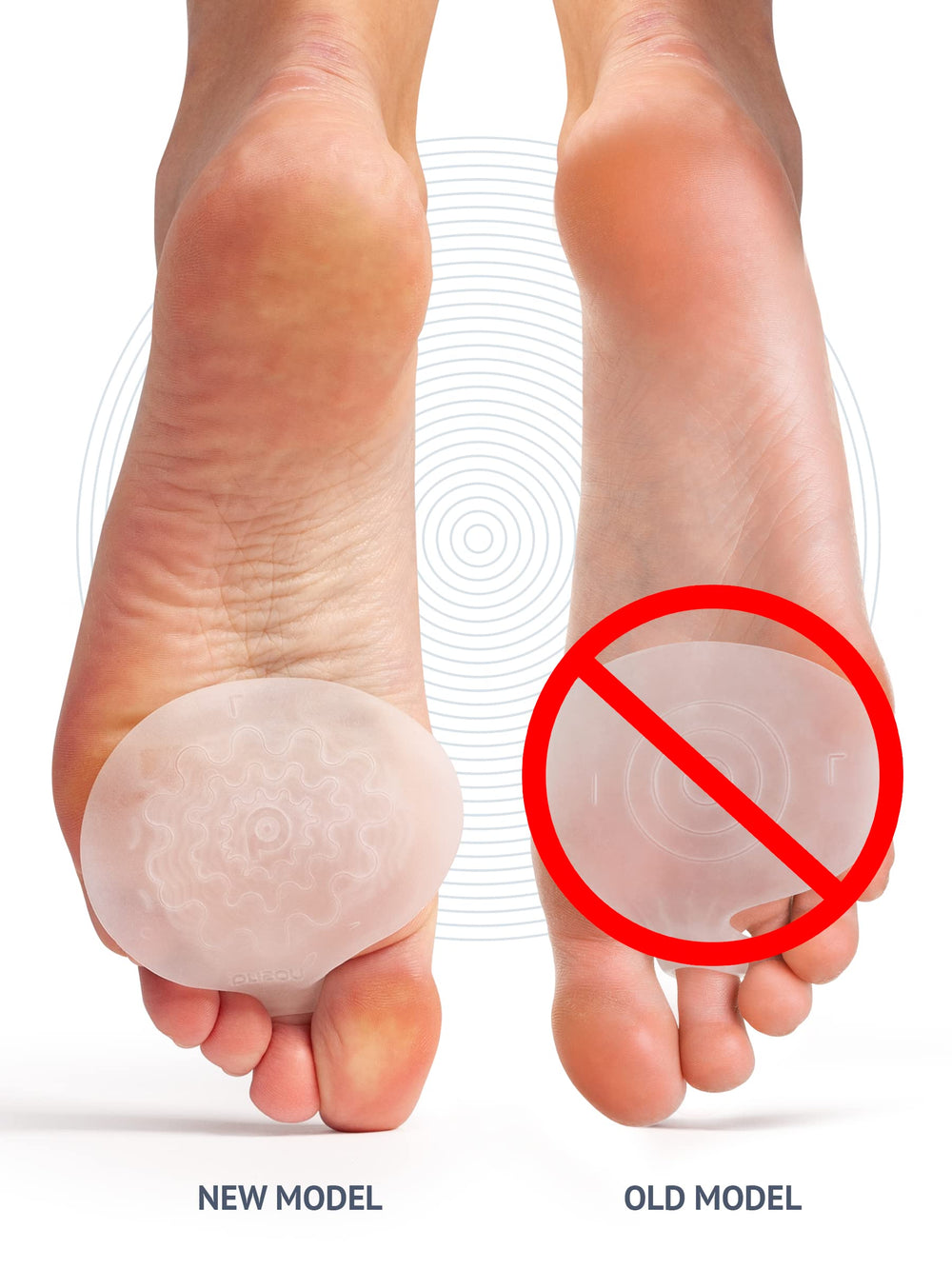 BRISON metatarsal pad unisex fit with toe ring stays secure.