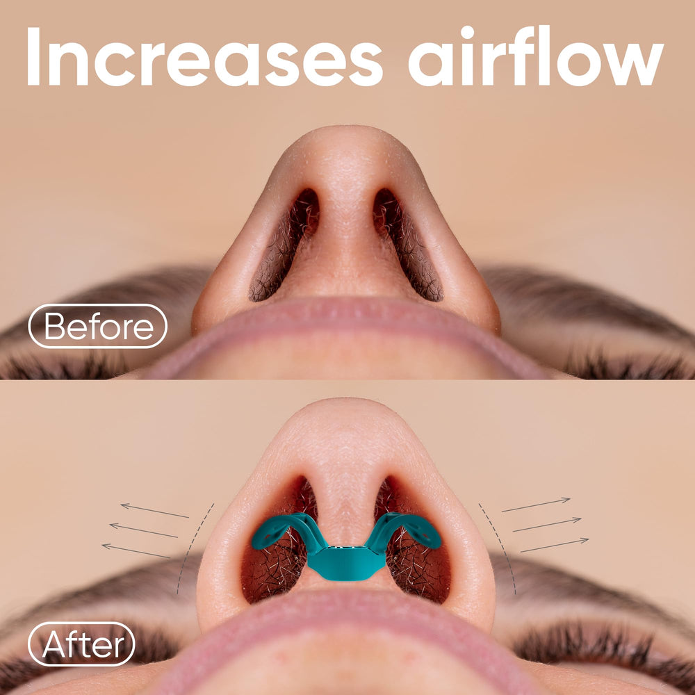 BRISON nasal dilators two-pack showing soft and firm options