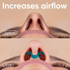 BRISON nasal dilators two-pack showing soft and firm options