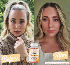 Bronze Bites strawberry-lemonade gummies for a refreshing skin-support routine
