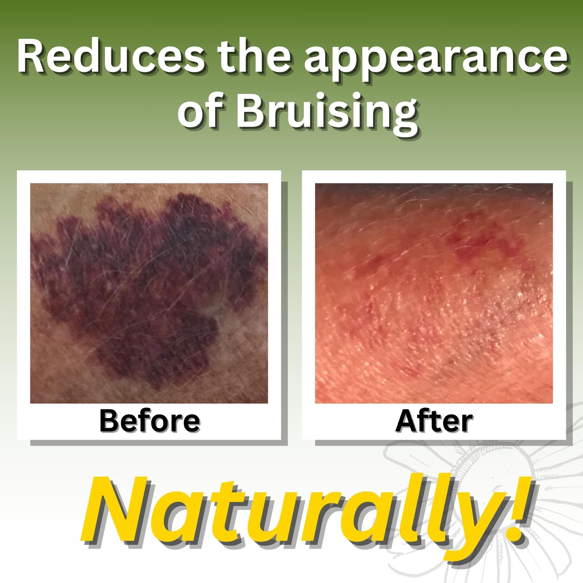 Brookethorne Naturals Relief Arnica Massage Oil bottle label showcasing USA-made, paraben-free formula.