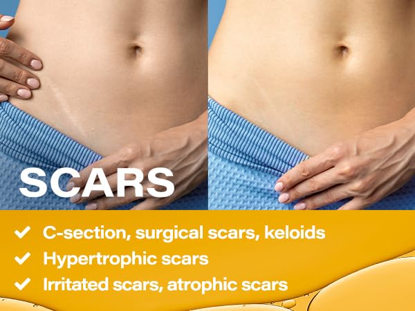 Bruizex oil used with massage tools to enhance recovery and relaxation.