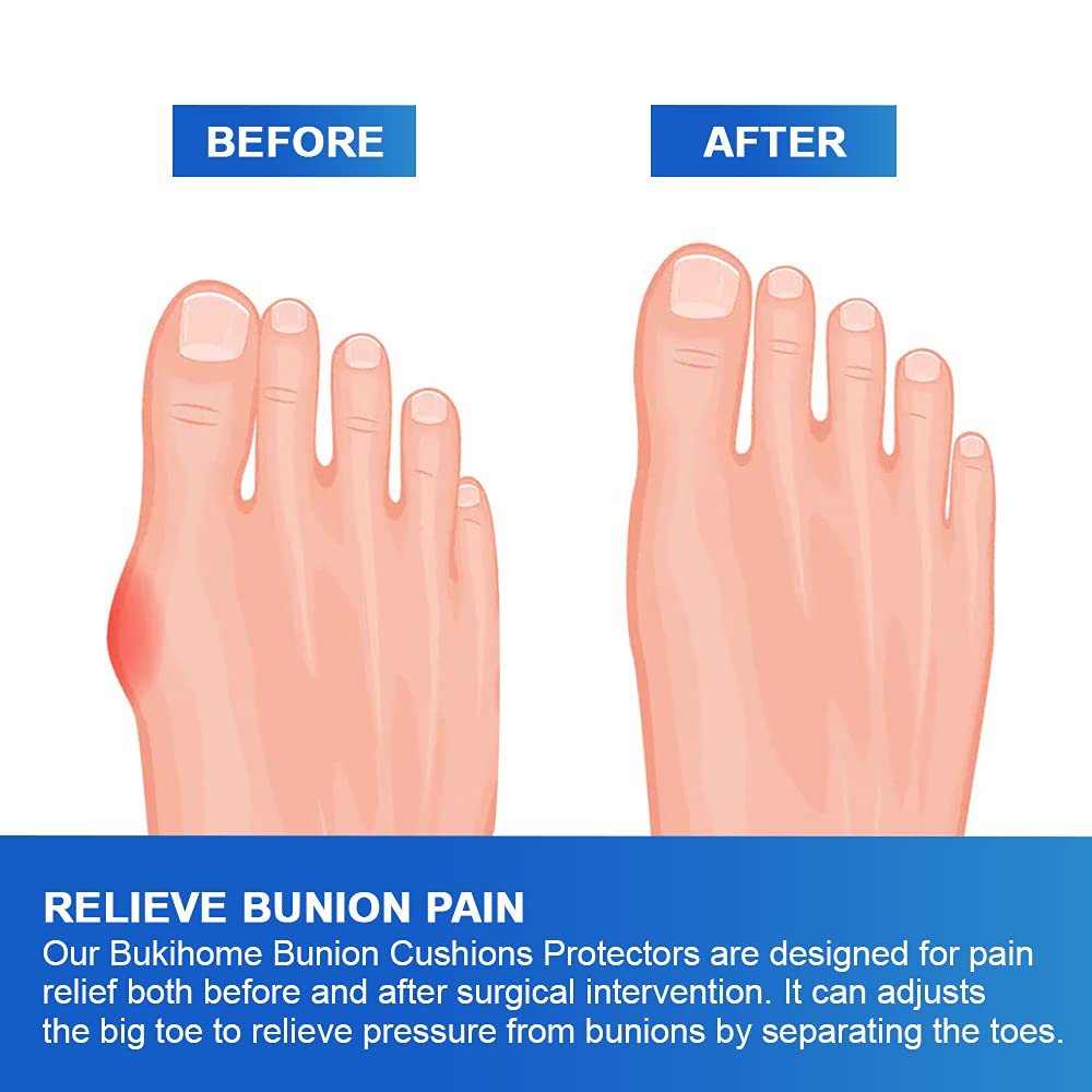Bukihome bunion pad over big toe provides secure non-slip fit.
