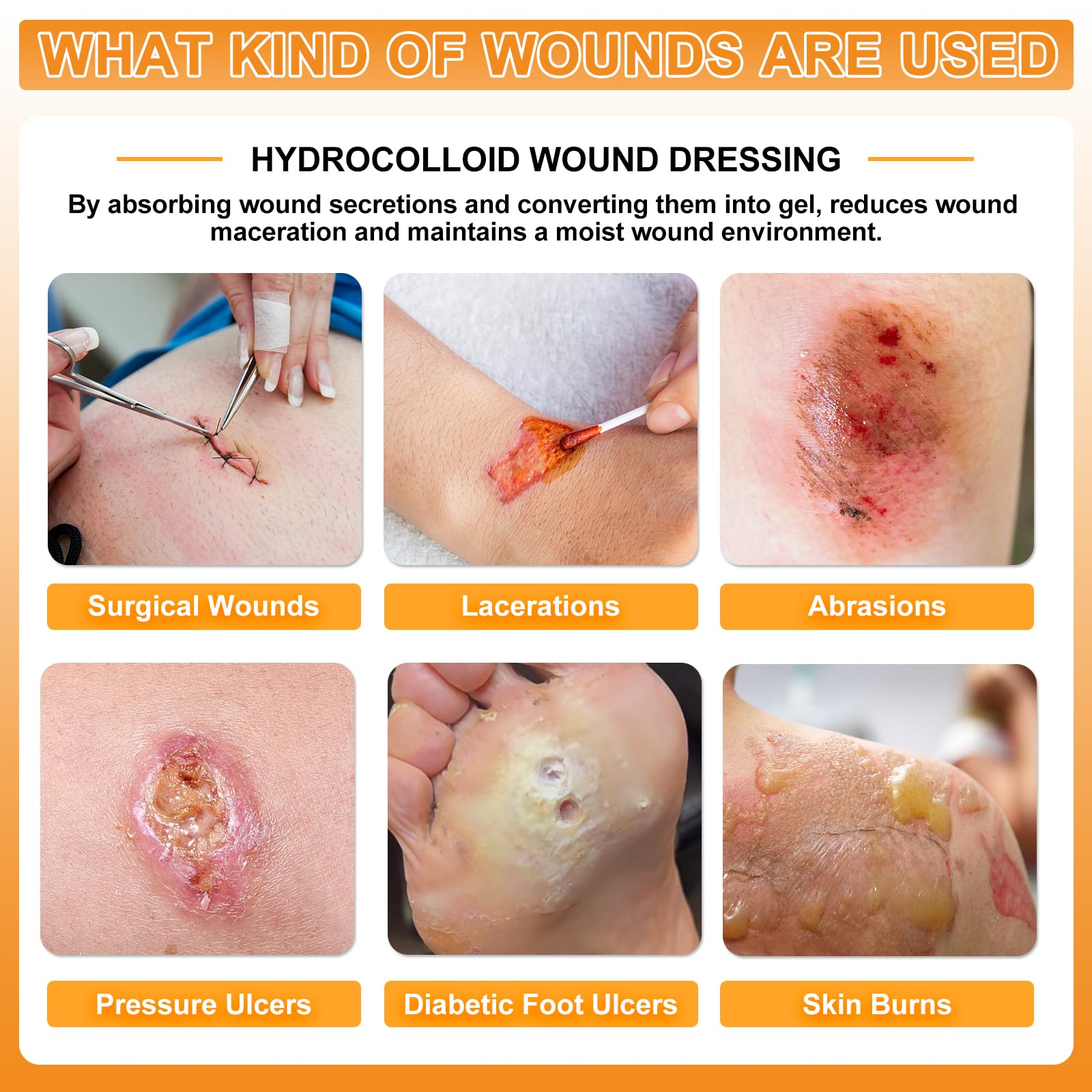 CARBOU hydrocolloid dressing self-adhesive bandage on skin provides gentle adhesion.