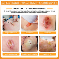 CARBOU hydrocolloid dressing self-adhesive bandage on skin provides gentle adhesion.
