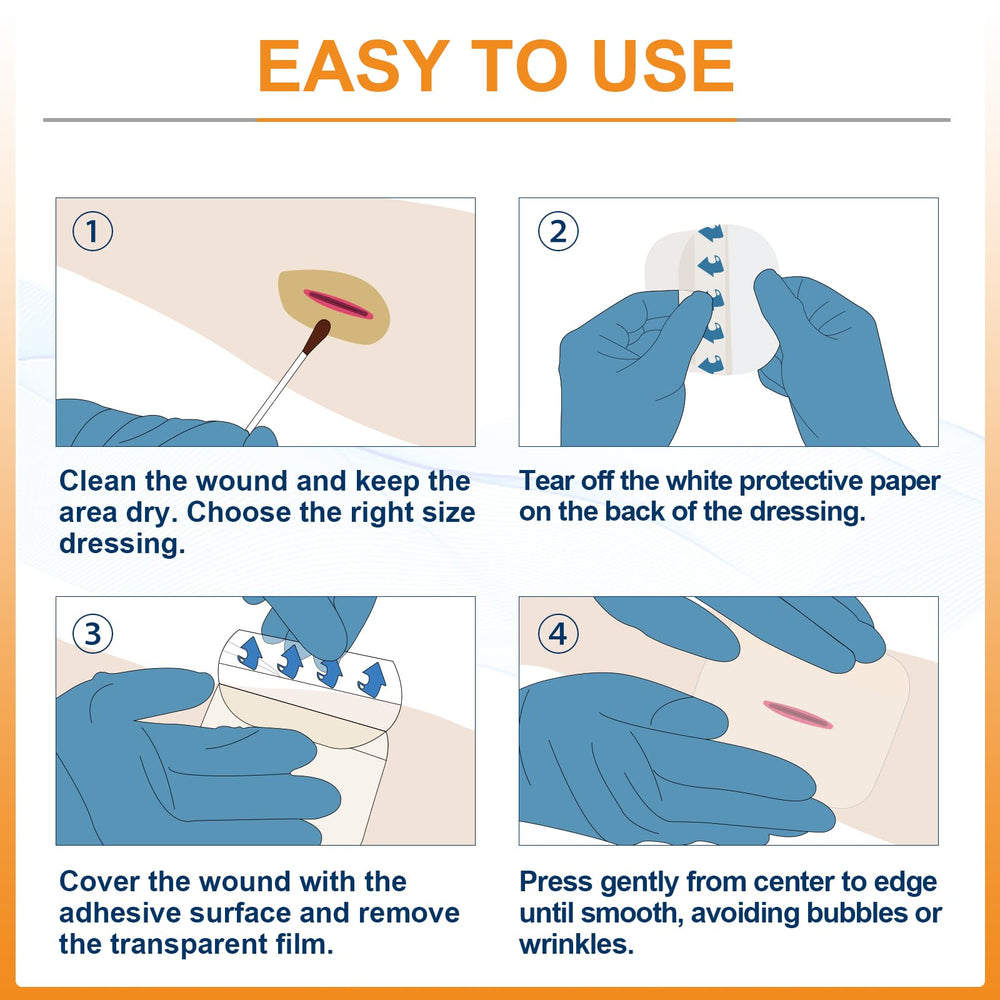 Carbou transparent wound dressing enables observation while protecting the wound.