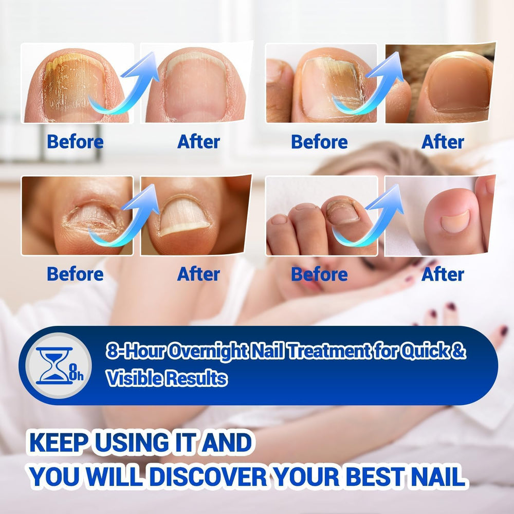 Chamex multi-pack patches for different nail sizes and needs.