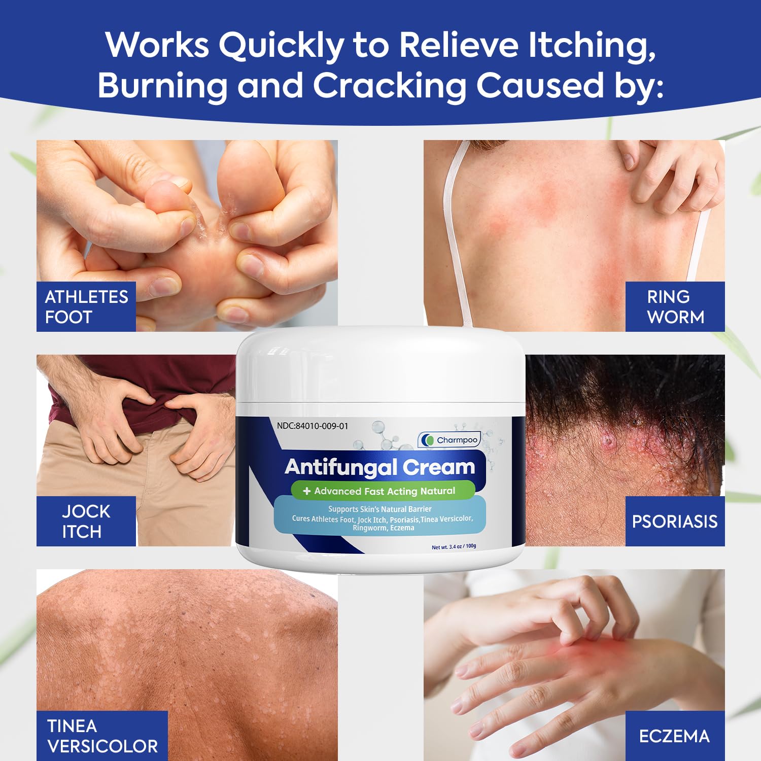 Charmpoo antifungal cream application tube ready for precise coverage