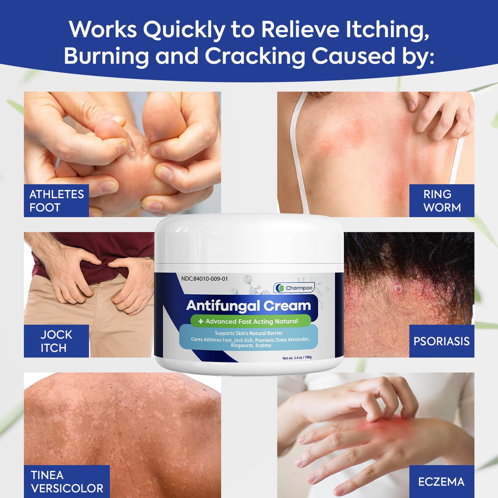 Charmpoo antifungal cream application tube ready for precise coverage