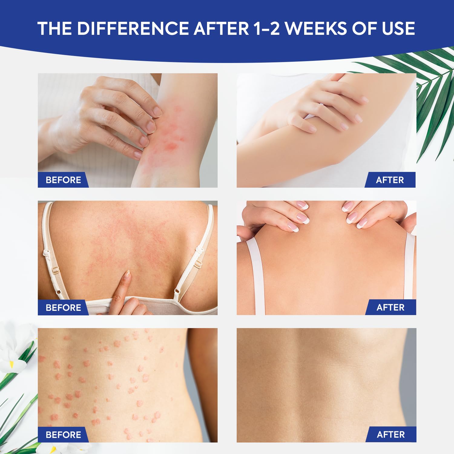 Charmpoo antifungal cream packaging emphasizing compact, travel-friendly size
