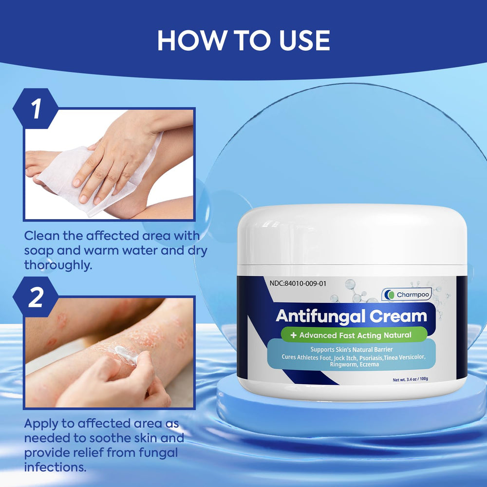 Charmpoo antifungal cream texture close-up highlights smooth, non-greasy finish