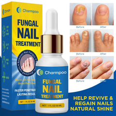CHARMPOO cuticle serum dropper emphasizing lightweight, fast-absorbing formula