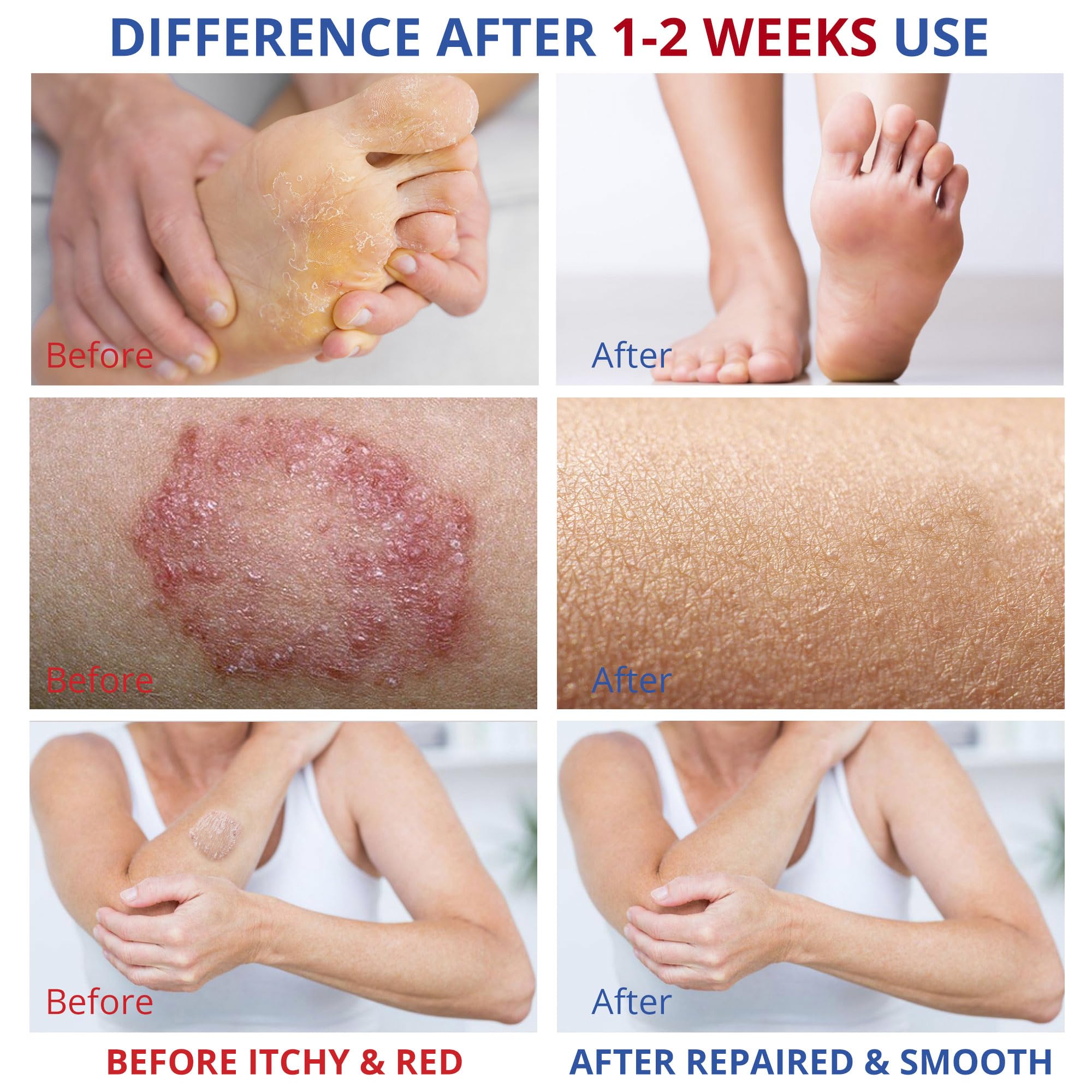 CHARMPOO foot care application scene showing non-greasy spread on skin