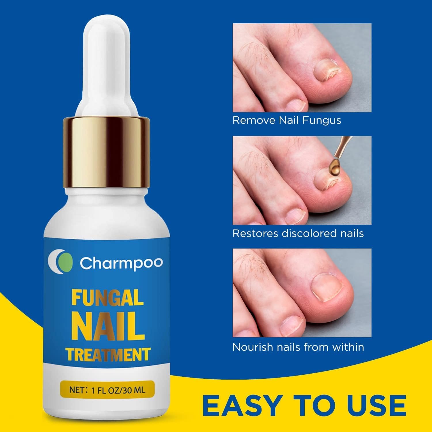 CHARMPOO lightweight serum dropper highlighting non-sticky, quick-absorption care