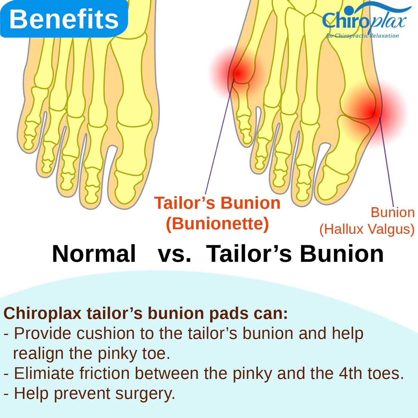 Chiroplax protector dedo meñique lavable, fácil de limpiar y reutilizable.