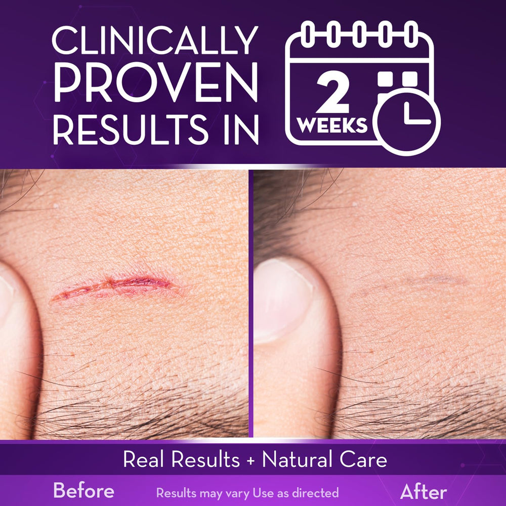 Cicatricure Advanced Scar Gel being applied to skin.