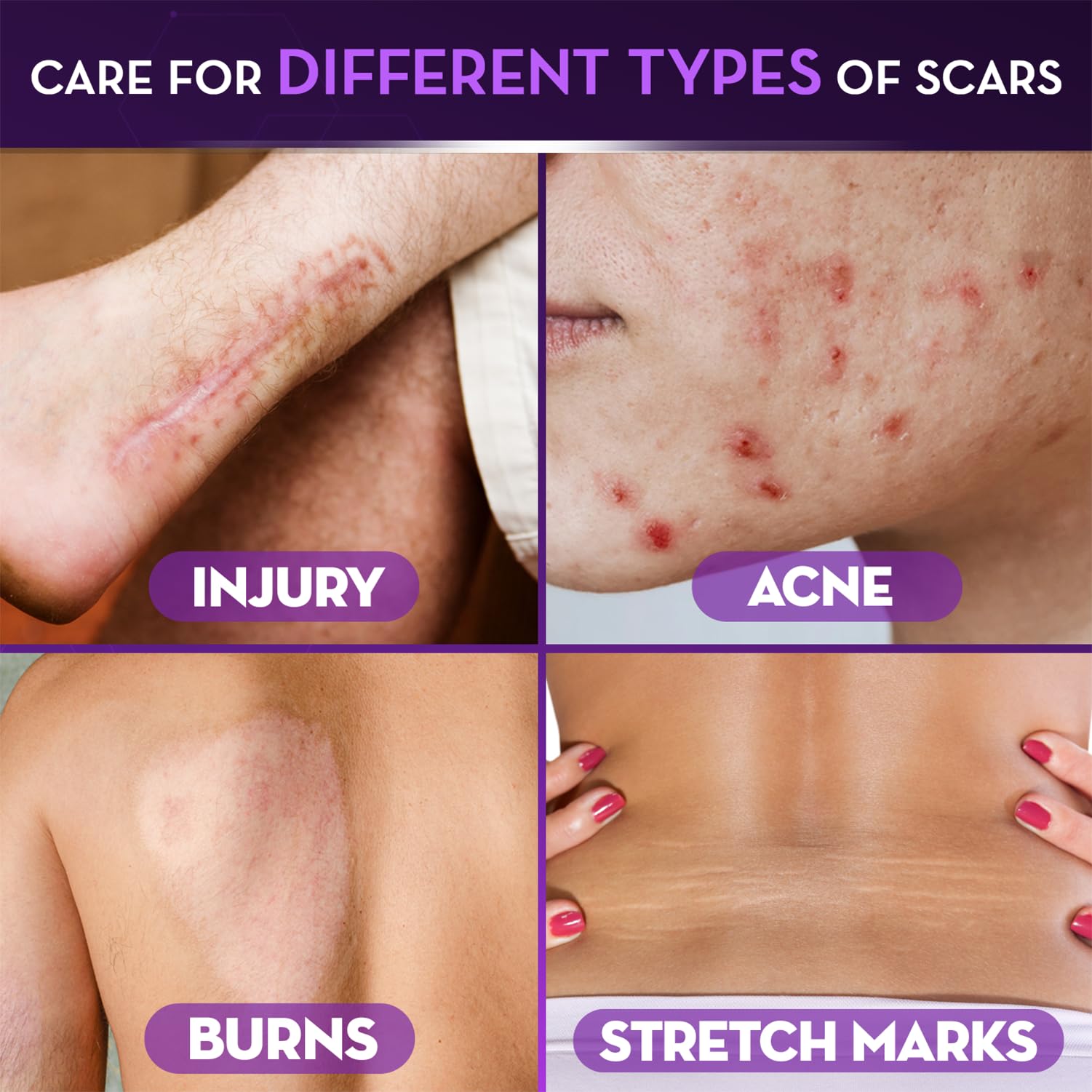 Cicatricure gel dispensing action on skin surface.