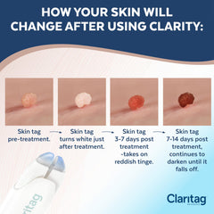 Claritag treatment-cycle diagram explains step-by-step use