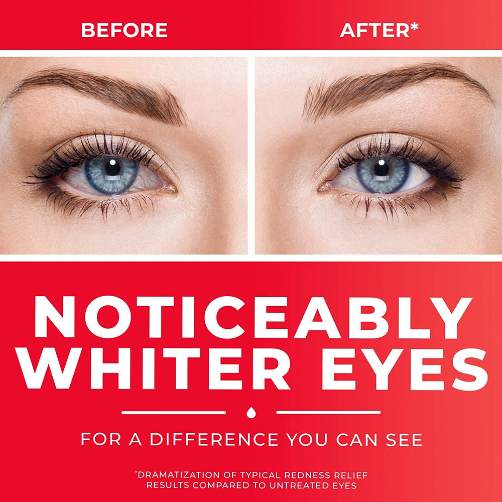 Clear Eyes ophthalmic drops tip closeup for hygienic use