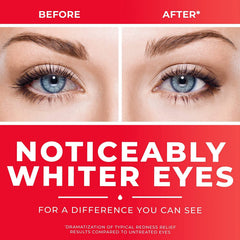 Clear Eyes ophthalmic drops tip closeup for hygienic use