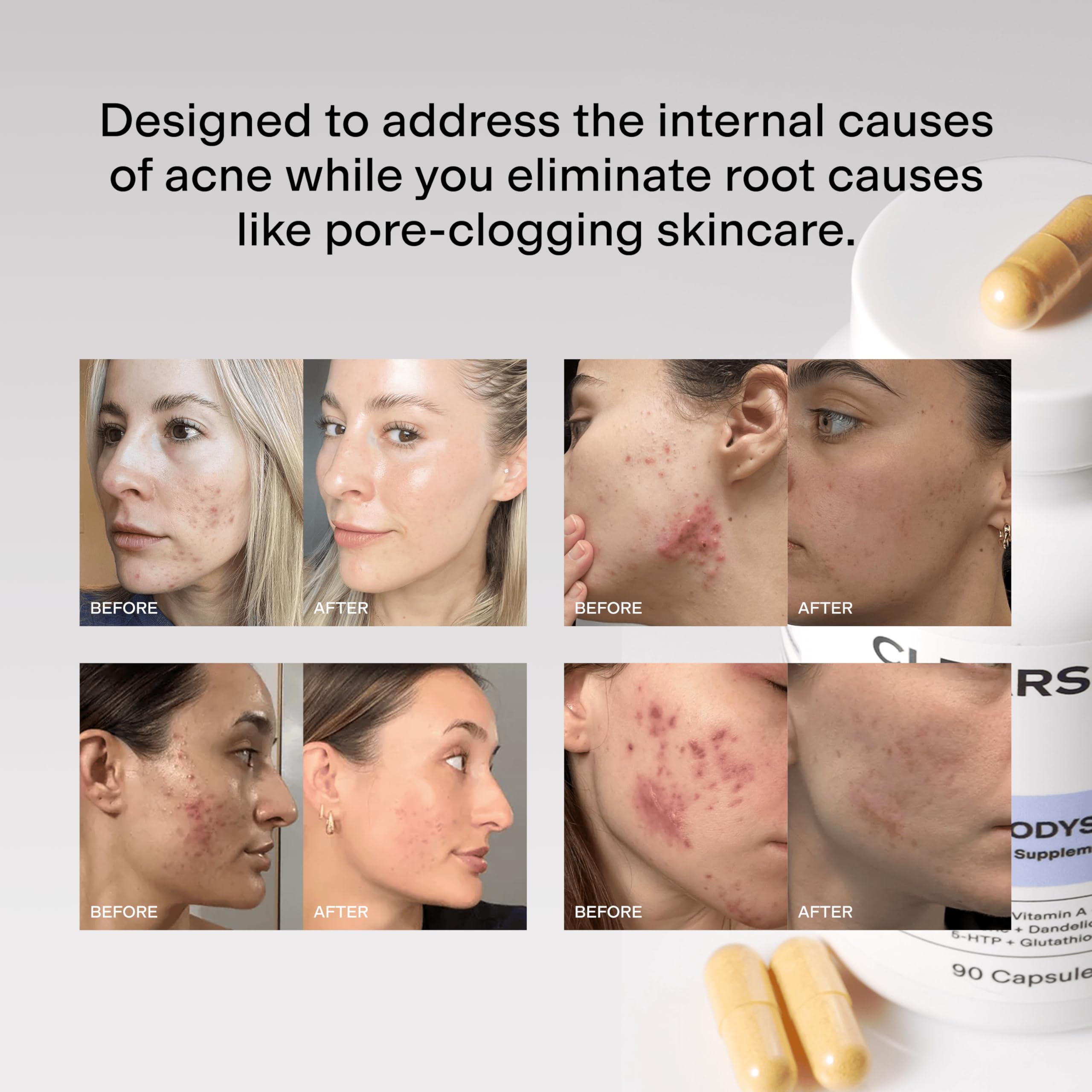 Daily routine with MindBodySkin promotes potential clearer skin