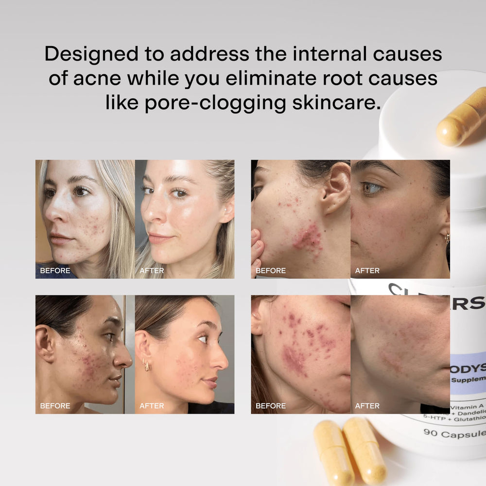 Daily routine with MindBodySkin promotes potential clearer skin