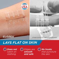 Clozex 1.5 inch closure for longer minor wounds