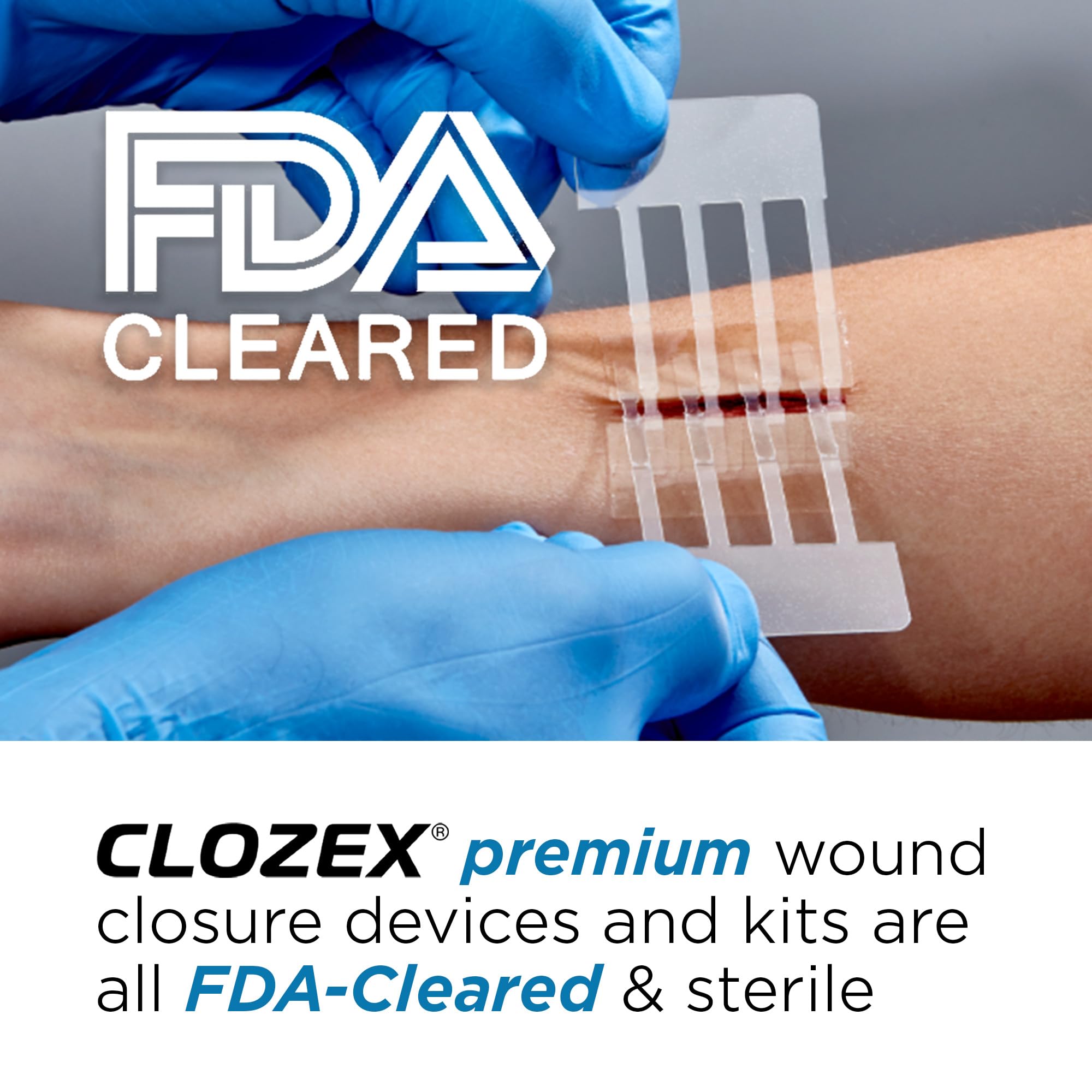 Clozex 1 inch closure demonstrating precise skin edge alignment