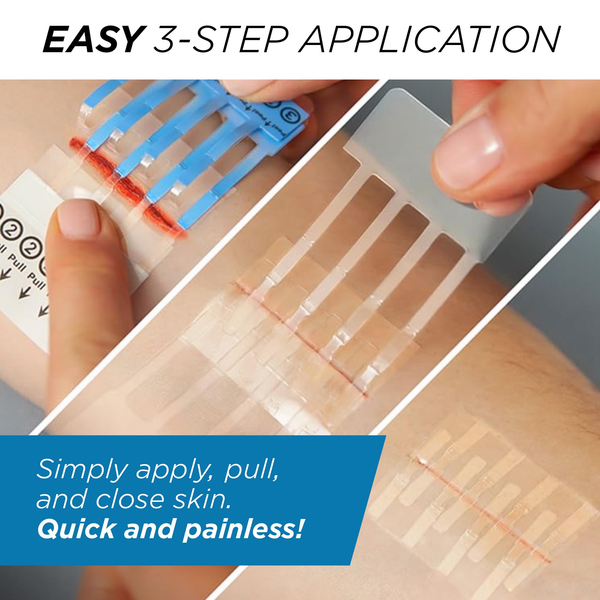 Clozex cover bandage protects the closed wound during healing.